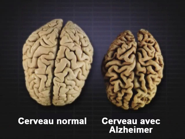 Image cerveau