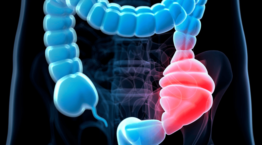 Constipation : une chose étonnante à savoir
